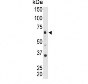 Western blot testing of mouse heart tissue lysate with MTMR9 antibody. Predicted molecular weight ~63 kDa.