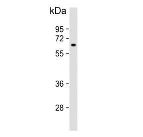 Western blot testing of human K562 cell lysate with MTMR9 antibody. Predicted molecular weight ~63 kDa.