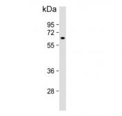 Western blot testing of human K562 cell lysate with MTMR9 antibody. Predicted molecular weight ~63 kDa.