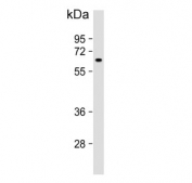 Western blot testing of human K562 cell lysate with MTMR9 antibody. Predicted molecular weight ~63 kDa.