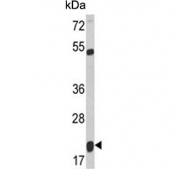 Western blot testing of human T-47D cell lysate with SMAC/Diablo antibody. Predicted molecular weight: 21-27 kDa.
