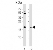 Western blot testing of human 1) HeLa and 2) Jurkat cell lysate with SMAC/Diablo antibody. Predicted molecular weight: 21-27 kDa.