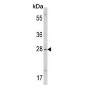 Western blot testing of human MDA-MB-231 cell lysate with Collectin 11 antibody. Predicted molecular weight ~29 kDa.
