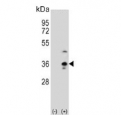 Western blot testing of 1) non-transfected and 2) transfected 293 cell lysate with Collectin 11 antibody.