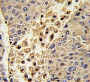 IHC testing of FFPE human tonsil tissue with Collectin 11 antibody. HIER: steam section in pH6 citrate buffer for 20 min and allow to cool prior to staining.