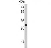 Western blot testing of mouse NIH 3T3 cell lysate with FHL1 antibody. Predicted molecular weight ~36 kDa.