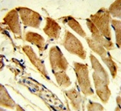 IHC testing of FFPE human skeletal muscle tissue with FHL1 antibody. HIER: steam section in pH6 citrate buffer for 20 min and allow to cool prior to staining.