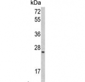 Western blot testing of human HL60 cell lysate with SRSF1 antibody. Predicted molecular weight ~28 kDa.