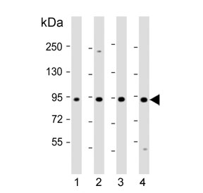Western blot testing of human 1) HepG2, 2) HUVEC, 3) Jurkat and 4) K562 cell lysate with Ras-interacting protein 1 antibody. Predicted molecular weight ~103 kDa.