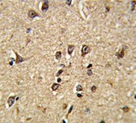 IHC testing of FFPE human brain tissue with Ras-interacting protein 1 antibody. HIER: steam section in pH6 citrate buffer for 20 min and allow to cool prior to staining.