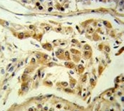 IHC testing of FFPE human testis tissue with Espin antibody. HIER: steam section in pH6 citrate buffer for 20 min and allow to cool prior to staining.
