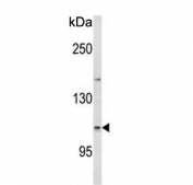 Western blot testing of human HEK293 cell lysate with Espin antibody. Predicted molecular weight ~92 kDa; isoforms can be observed at ~110 kDa and ~30 kDa.