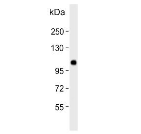 Western blot testing of human SK-BR-3 cell lysate with Espin antibody. Predicted molecular weight ~92 kDa; isoforms can be observed at ~110 kDa and ~30 kDa.