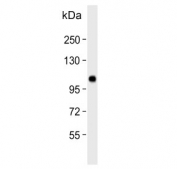 Western blot testing of human SK-BR-3 cell lysate with Espin antibody. Predicted molecular weight ~92 kDa; isoforms can be observed at ~110 kDa and ~30 kDa.