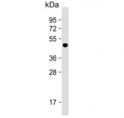 Western blot testing of human HepG2 cell lysate with Galactose-1-phosphate uridylyltransferase antibody. Predicted molecular weight ~43 kDa.