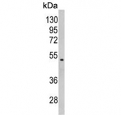 Western blot testing of human MDA-MB-231 cell lysate with Galactose-1-phosphate uridylyltransferase antibody. Predicted molecular weight ~43 kDa.