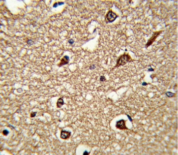 IHC testing of FFPE human tonsil tissue with HLA-DRB1 antibody. HIER: steam section in pH6 citrate buffer for 20 min and allow to cool prior to staining.