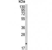 Western blot testing of human A2058 cell lysate with Ferritin heavy chain antibody. Predicted molecular weight ~21 kDa.