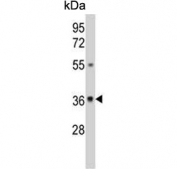 Western blot testing of human A375 cell lysate with UDP-glucose 4-epimerase antibody. Predicted molecular weight ~38 kDa.