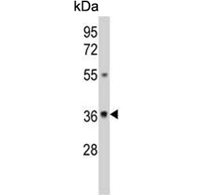 Western blot testing of human A375 cell lysate with UDP-glucose 4-epimerase antibody. Predicted molecular weight ~38 kDa.