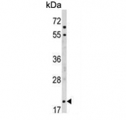 Western blot testing of human HEK293 cell lysate with MOBP antibody. Predicted molecular weight ~21 kDa.