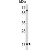Western blot testing of mouse cerebellum tissue lysate with MOBP antibody. Predicted molecular weight ~21 kDa.