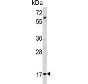 Western blot testing of mouse cerebellum tissue lysate with MOBP antibody. Predicted molecular weight ~21 kDa.