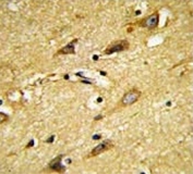 IHC testing of FFPE human brain tissue with MOBP antibody. HIER: steam section in pH6 citrate buffer for 20 min and allow to cool prior to staining.