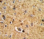 IHC testing of FFPE human brain tissue with Tryptophan Hydroxylase antibody. HIER: steam section in pH6 citrate buffer for 20 min and allow to cool prior to staining.