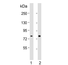 Western blot testing of human 1) CCRF-CEM and 2) Jurkat cell lysate with NADH-ubiquinone oxidoreductase chain 5 antibody. Expected molecular weight: 65-70 kDa.