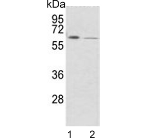 Western blot testing of human 1) K562 and 2) A2058 cell lysate with FPGS antibody. Predicted molecular weight ~65 kDa.