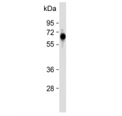 Western blot testing of human placental tissue with FPGS antibody. Predicted molecular weight ~65 kDa.