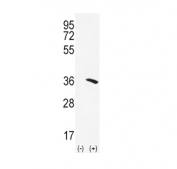 Western blot testing of 1) non-transfected and 2) transfected 293 cell lysate with NAT2 antibody.