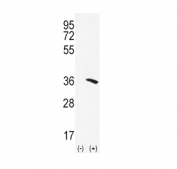 Western blot testing of 1) non-transfected and 2) transfected 293 cell lysate with NAT2 antibody.