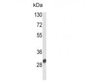 Western blot testing of mouse kidney tissue lysate with NAT2 antibody. Predicted molecular weight ~33 kDa.