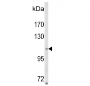 Western blot testing of human MDA-MB-231 cell lysate with SORBS2 antibody. Predicted molecular weight ~124 kDa.