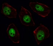 Immunofluorescent staining of fixed and permeabilized human U-251 cells with SORBS2 antibody (green) and anti-Actin (red).