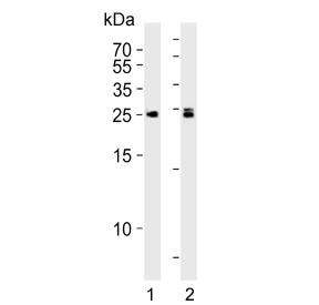 Western blot testing of human 1) K562 and 2) Daudi cell lysate with MOB kinase activator 1B antibody. Predicted molecular weight ~25 kDa.