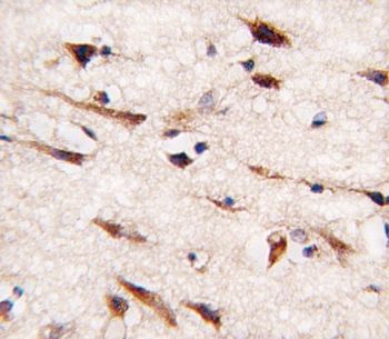 IHC testing of FFPE human brain tissue with MOB kinase activator 1B antibody. HIER: steam section in pH6 citrate buffer for 20 min and allow to cool prior to staining.