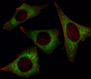Immunofluorescent staining of fixed and permeabilized mouse NIH 3T3 cells with MOB kinase activator 1B antibody (green) and anti-Actin (red).
