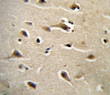 IHC testing of FFPE human brain tissue with Deoxycytidine kinase antibody. HIER: steam section in pH6 citrate buffer for 20 min and allow to cool prior to staining.