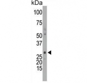 Western blot testing of mouse intestine tissue lysate with Deoxycytidine kinase antibody. Predicted molecular weight ~31 kDa.