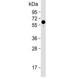Western blot testing of human HeLa cell lysate with Pyruvate Kinase PKM antibody. Predicted molecular weight ~58 kDa.