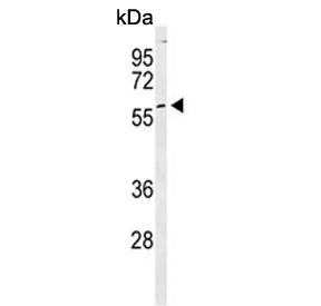 Western blot testing of human K562 cell lysate with Pyruvate Kinase PKM antibody. Predicted molecular weight ~58 kDa.