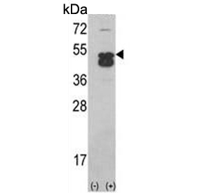 Western blot testing of 1) non-transfected and 2) transfected 293 cell lysate with CAMK1 delta antibody.
