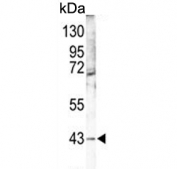 Western blot testing of mouse lung tissue lysate with MAPK12 antibody. Expected molecular weight: 38-42 kDa.