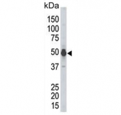 Western blot testing of mouse kidney tissue lysate with PHKG2 antibody. Predicted molecular weight ~44 kDa.