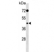 Western blot testing of human HeLa cell lysate with PHKG2 antibody. Predicted molecular weight ~44 kDa.