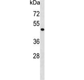 Western blot testing of human HepG2 cell lysate with PHKG2 antibody. Predicted molecular weight ~44 kDa.