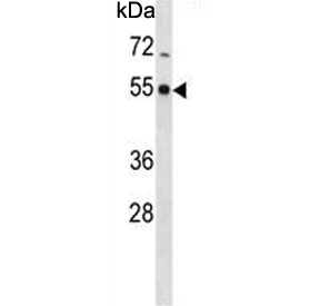 Western blot testing of mouse kidney tissue lysate with PHKG2 antibody. Predicted molecular weight ~44 kDa.